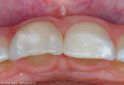 6 intraoral detail final